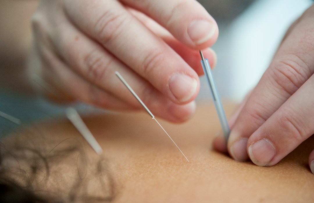 How a Great Chiropractor Can Change Your Life for the Better 3 img